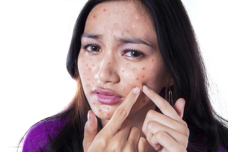 Teenage girl removing pimple on her cheek by touching it with her fingers, isolated on white Teenage girl removing pimple on her cheek by touching it with her fingers, isolated on white