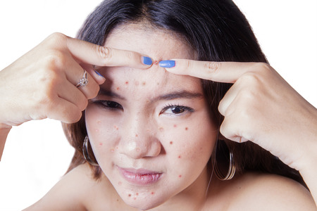 Asian teenage girl using her finger to clean acne from her face, isolated over white backgroundの写真素材