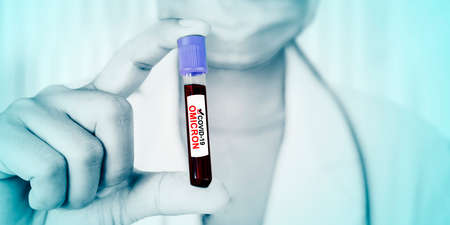 Close up of male doctor hand holding an infected blood sample tube of covid-19 omicron variantの写真素材