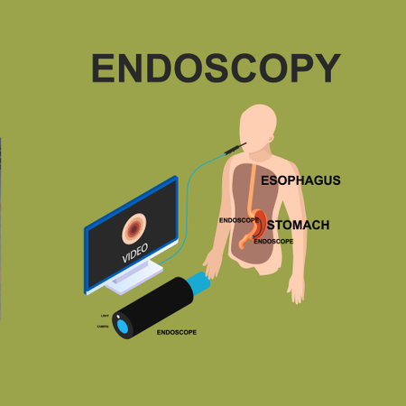 Endoscopy for GERD isometric 3d vector illustration concept for banner, website, illustration, landing page, flyer, etc.のイラスト素材