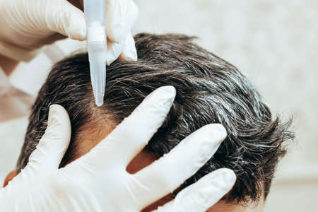 A cosmetologist performs anti-aging procedures, applies hyaluronic acid serum to the scalp, for hair growthの写真素材