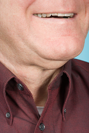 Chin of a man