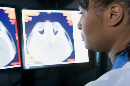 Doctor looking at brain scansの写真素材