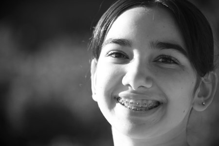Portrait of a young girl with braces on her teeth. Black and white.の写真素材