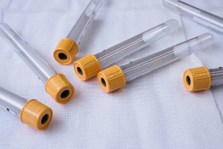 Plastic test tubes with caps for the collection of samples. Blood sampling tubes.の写真素材