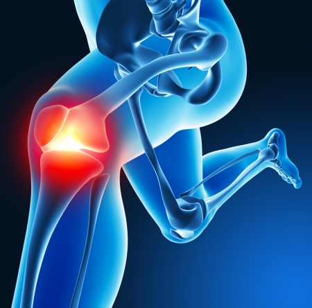 Leg joint painの写真素材