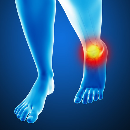 Woman joint painの写真素材