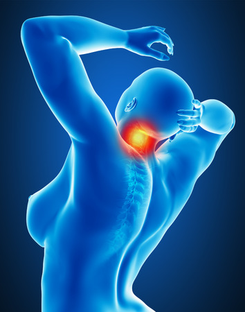Woman joint painの写真素材