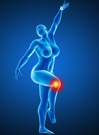 Woman joint painの写真素材