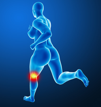 Woman joint painの写真素材