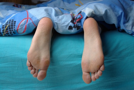 Female feet with callusの写真素材