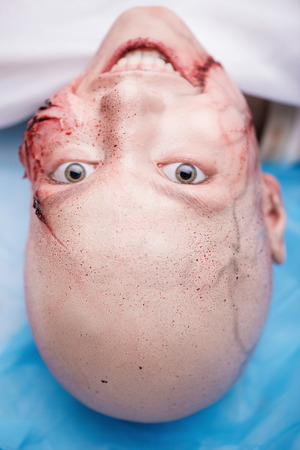 Smiling woman getting into the accident having a big terrible gash on her face. Top viewの写真素材