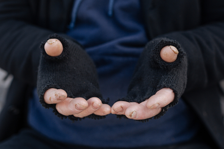 Close up of sore hands wearing glovesの写真素材