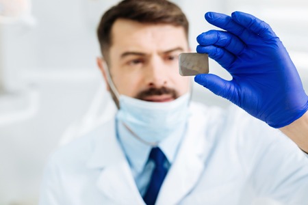 Serious problem. Close up of dental Xray image in hands on professional dentist standing in front of youの写真素材