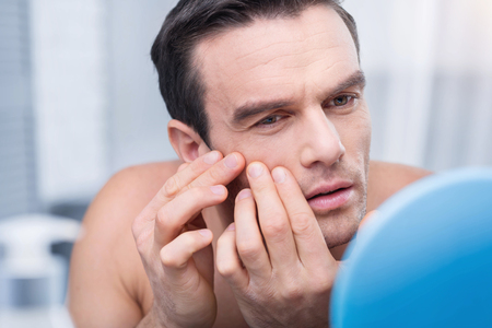 Annoying pimples. Cute earnest brunette man getting rid of pimples when placeng hands on the face  and  looking  at the mirrorの写真素材