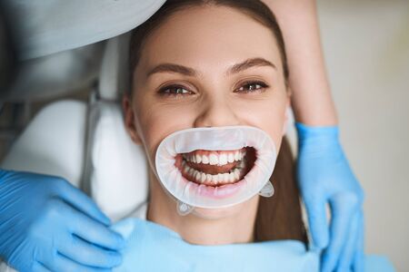 Jolly young woman is having fun with open mouth in dental office during teeth treatmentの写真素材