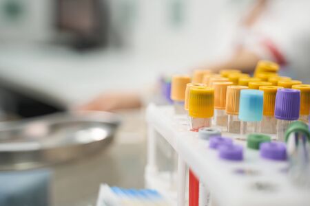 Colorful plastic parts being on the glass test tubes, silhouette of doctor that sampling bloodの写真素材