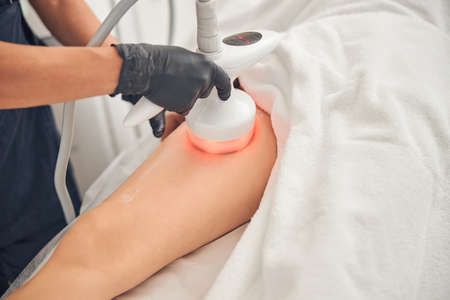 Cropped photo of beautician doing cavitation procedure on a female client at a beauty centerの写真素材