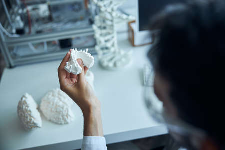 Cropped photo of a Caucasian man holding the 3D printed teeth model in his hand