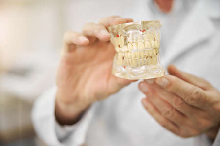 Close-up photo of doctors hands holding a full jaws dental implant