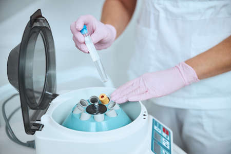 Cropped photo of a woman doctor placing a tube into the platelet-rich plasma centrifuge machine