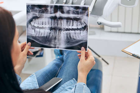 Kind brunette female holding X-ray picture, being at stomatology while doing tooth checkupの写真素材