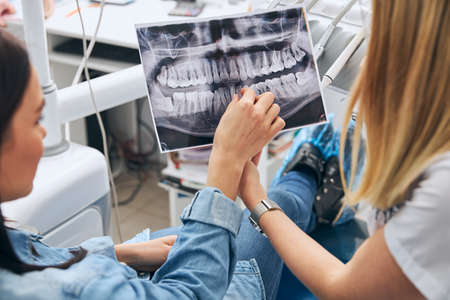 Attentive patient pointing at roentgen photo while being on professional consultationの写真素材