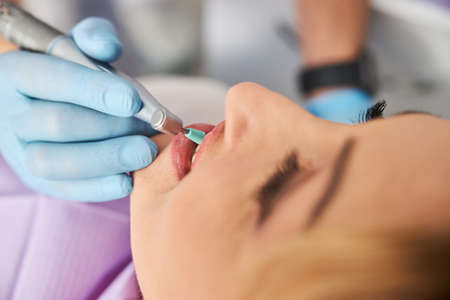 Dental tool with rubber cup in medical professional hand removing dental plaque from woman teeth