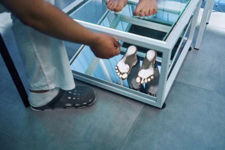 Close-up examination of girl bare feet on plantoscope platform by pediatrician in therapeutic officeの写真素材