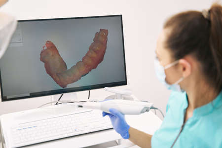 Dentist analyzing 3D scan of patient teeth in clinicの写真素材