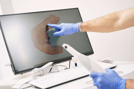 Male dentist hand pointing at computer display with dental 3D scanの写真素材