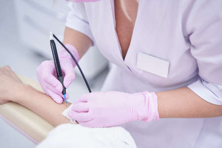 Experienced doctor excising nevus with wire loop electrode