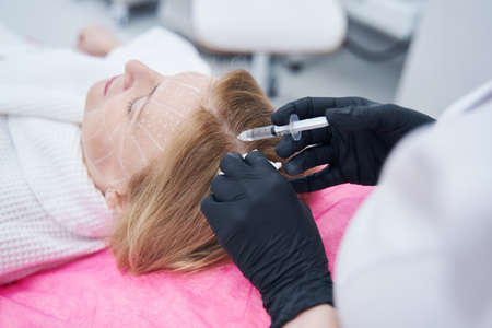 Woman receiving injection into scalp during mesotherapy treatmentの写真素材