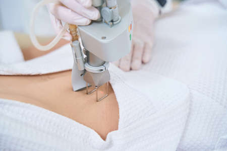 Cosmetologist performs the procedure for removing neoplasms with a laser