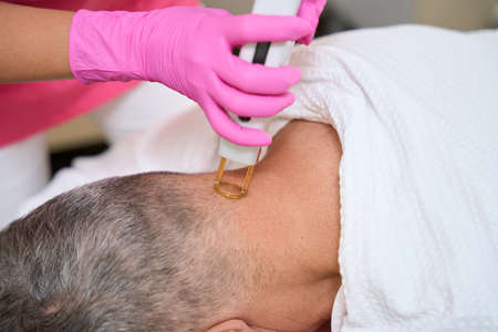 Female hands with laser epilator remove hair on back head