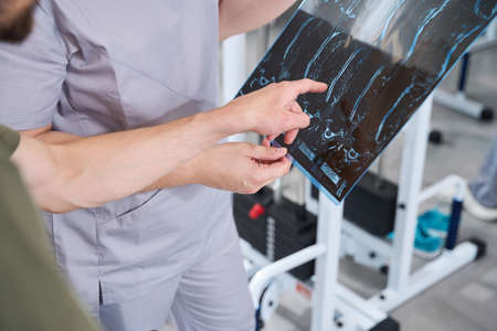 Doctor with patient examining x-rays of injuriesの写真素材