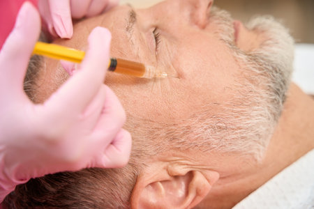 Female hands of cosmetologist injecting beauty injection into cheekの写真素材