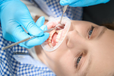 Dentist conducts professional cleaning of boy teeth in protective glovesの写真素材