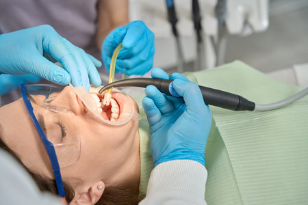 Dentist carrying out teeth-whitening procedure on client assisted by nurseの写真素材