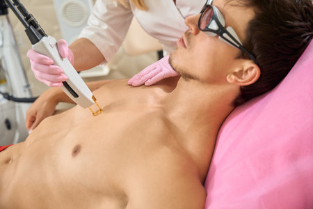 Female cosmetologist conducts a laser hair removal session for clientの写真素材