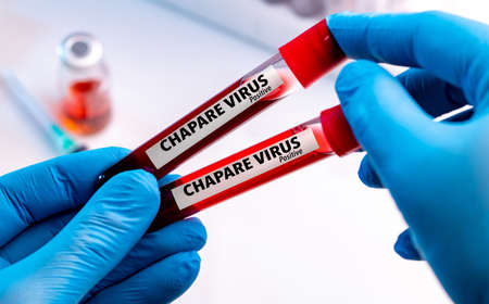 Nurse wearing respiratory mask holding a positive blood test result for Chapare Mammarenavirus