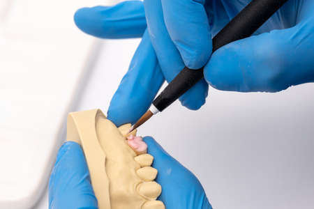 Dental technician using a brush with ceramic dental implants in his laboratory.