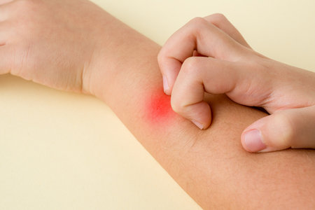 The insect bite on the girl's arm is adjusting and itching