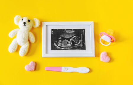 Ultrasound picture of a baby's photograph and accessories. Selective focus. child.の写真素材
