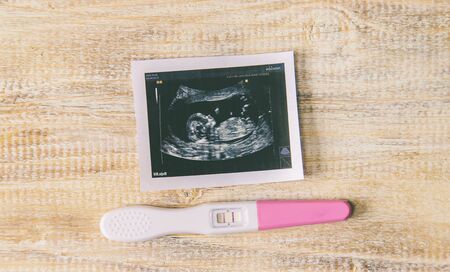 Ultrasound picture of a baby's photograph and accessories. Selective focus. child.