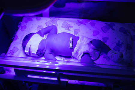 Newborn baby under an ultraviolet lamp. Selective focus. people.の写真素材