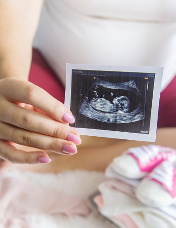 A pregnant woman holds a snapshot of an ultrasound in her hands. Selective Focus. people.の写真素材