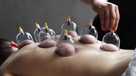 Cup massage close up. Banks for massage on the man's back. Massage with vacuum cups.の写真素材
