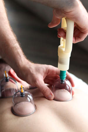 Massage vacuum cups. Close-up of man lying with banks on his back in spa salon. Vacuum jars in...