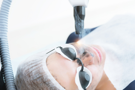 Close-up carbon face peeling procedure. Laser pulses clean skin of the face. Hardware cosmetology treatment. Process of photothermolysis, warming the skin, laser carbon peeling. Facial skin rejuvenation.の写真素材